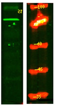 PPM1E rabbit pAb Antibody