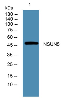 NSUN5 rabbit pAb Antibody
