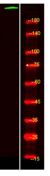 PTPRB rabbit pAb Antibody