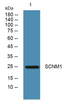 SCNM1 rabbit pAb Antibody