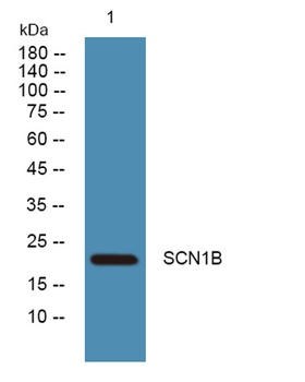 SCN1B rabbit pAb Antibody