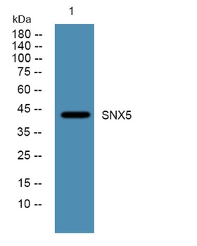 SNX5 rabbit pAb Antibody