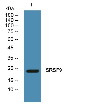 SRSF9 rabbit pAb Antibody