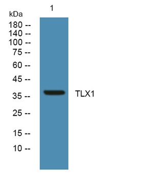 TLX1 rabbit pAb Antibody