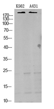 TRPM7 rabbit pAb Antibody