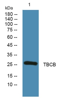 TBCB rabbit pAb Antibody