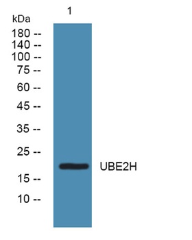 UBE2H rabbit pAb Antibody