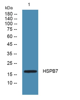 HSPB7 rabbit pAb Antibody