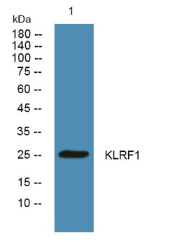 KLRF1 rabbit pAb Antibody