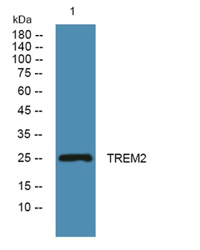 TREM2 rabbit pAb Antibody