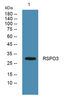 RSPO3 rabbit pAb Antibody
