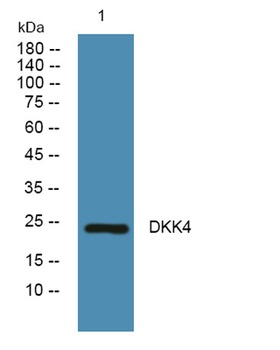 DKK4 rabbit pAb Antibody