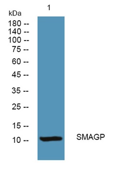 SMAGP rabbit pAb Antibody