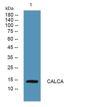 CALCA rabbit pAb Antibody
