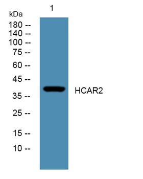 HCAR2 rabbit pAb Antibody