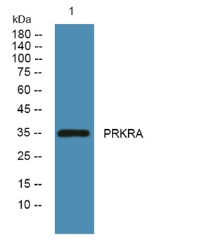 PRKRA rabbit pAb Antibody