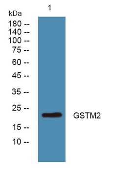 GSTM2 rabbit pAb Antibody