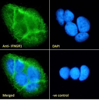 Goat anti-IFNGR1 (aa181-193) Antibody