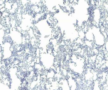 Goat anti-IFNGR1 (aa181-193) Antibody