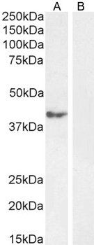 Calcipressin-1 Antibody