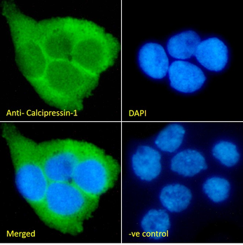 Calcipressin-1 Antibody