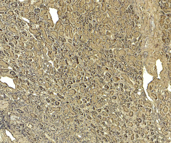 TRPM7/LTRPC7 Antibody