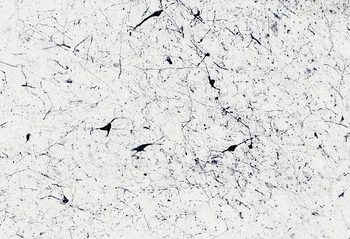 NOS1 Antibody