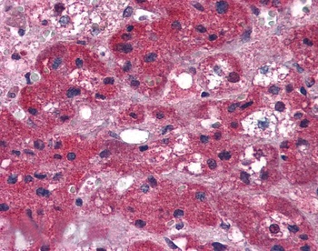 ARIH1/HHARI Antibody