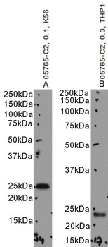 Goat anti-HSPC150 / UBE2T Antibody