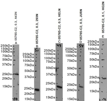 Goat anti-HSPC150 / UBE2T Antibody