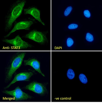 STAT3 (isoform 1 and 2) Antibody