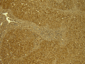 STAT3 (isoform 1 and 2) Antibody