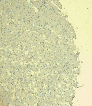 STAT3 (isoform 1 and 2) Antibody