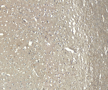 AIF1/IBA1 isoform 1 and 3 Antibody
