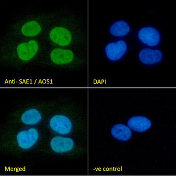 SAE1/AOS1 Antibody