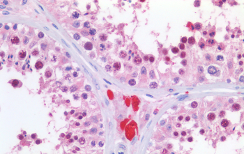 KPNA2/IPOA1 Antibody