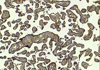SIRT4 Antibody