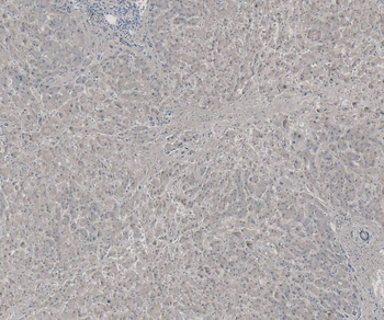 58KGolgi protein(Internal)/FTCD Antibody