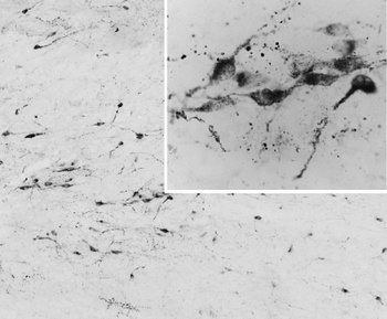 AGRP/Agouti-related protein Antibody