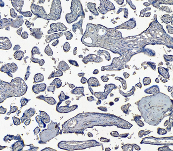 ENPP1/PC1 Antibody