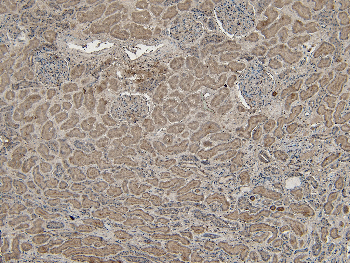 VPS25 Antibody