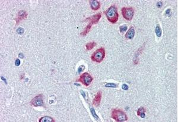PCK1/PEPCKC (internal) Antibody