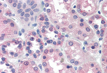 PCK1/PEPCKC (internal) Antibody