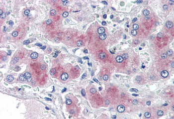 PCK1/PEPCKC (internal) Antibody