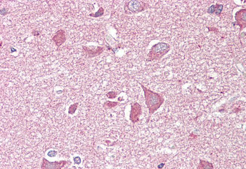 NCAM2/OCAM Antibody