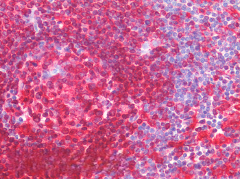 CD74 (aa159-171) Antibody