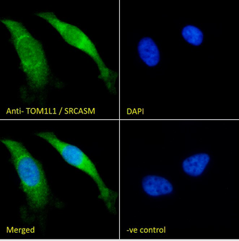 TOM1L1/SRCASM Antibody
