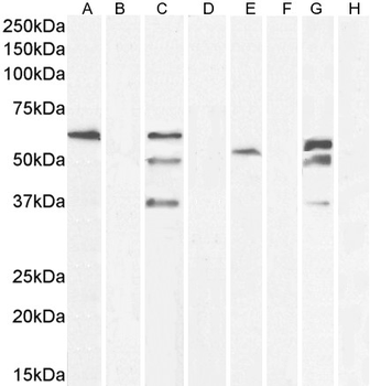 TOM1L1/SRCASM Antibody