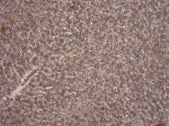 KCNQ1 Antibody