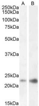 CAV3 Antibody